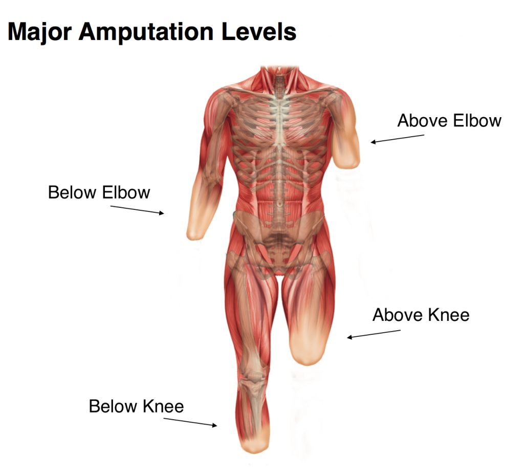 amputation_levels_guide